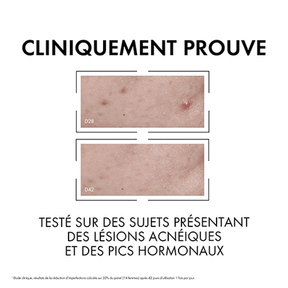 Vichy normaderm sérum anti-imperfections probio-bha 30ml