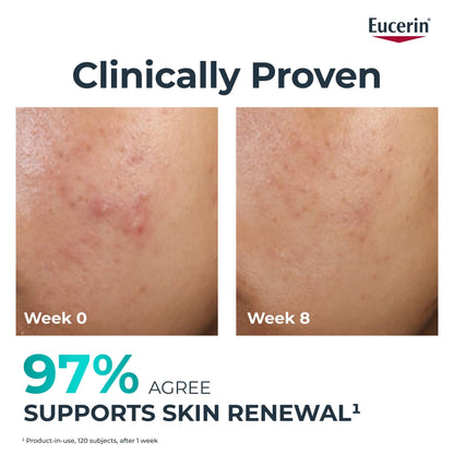 EUCERIN DERMOPURE CLINICAL PEELING 10 SOIN DE NUIT RENOVATEUR 40ML